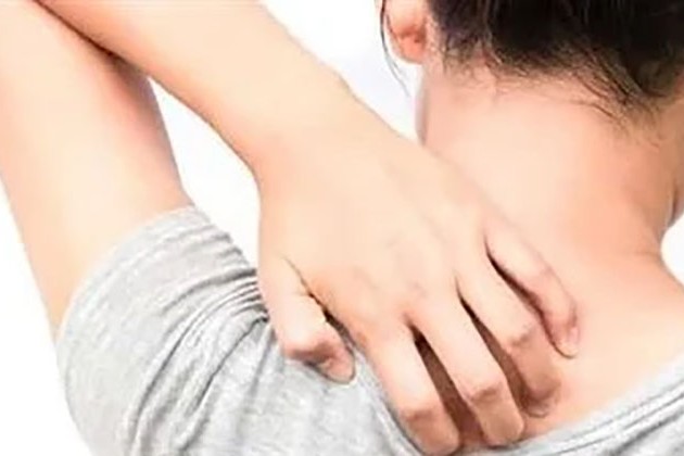 أسباب غير متوقعة لحكة أسفل الساقين وطرق التخلص منها