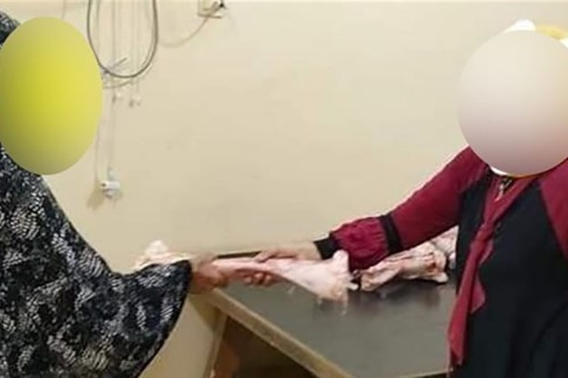 حقيقة فيديو توزيع عظام لحوم على أسرة بالإسكندرية