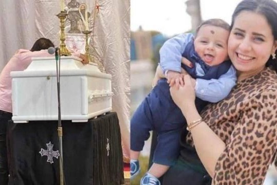 شاهد .. عقب واقعة مارينا صلاح : الحداد يكشف كيفية التعامل مع الحساسية ضد الأدوية والصبغة