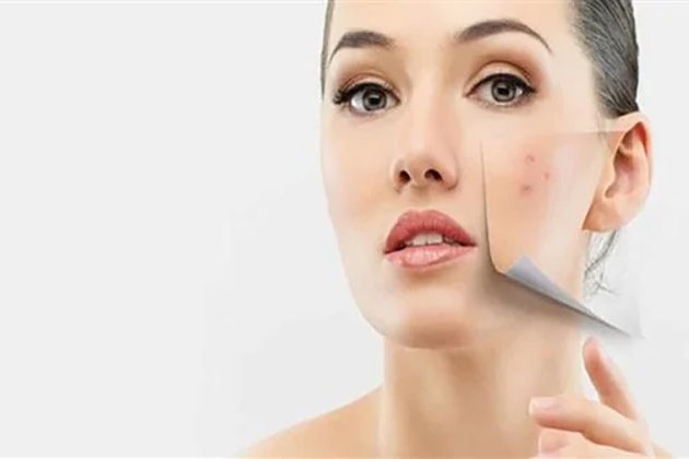 أسرع العلاجات للتخلص من البقع الداكنة في الوجه